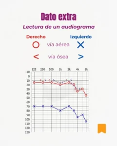 ¿Cómo funciona una audiometría? Te lo explicamos en 4 pasos 5 ¿Cómo funciona la audiometría?